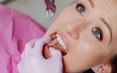 Was tun bei Dentalphobie?